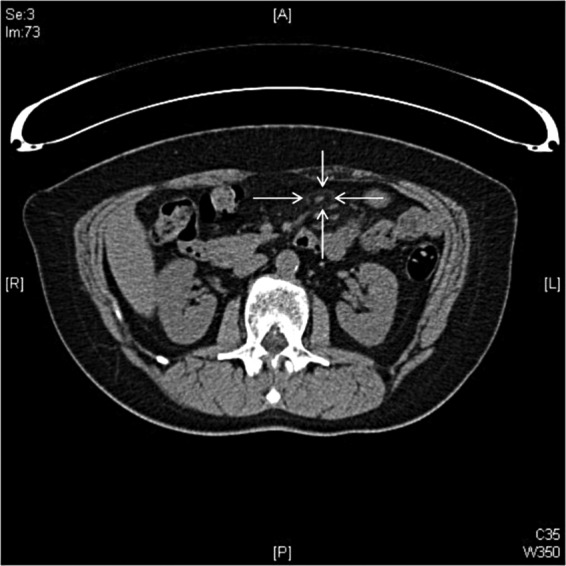 Figure 2