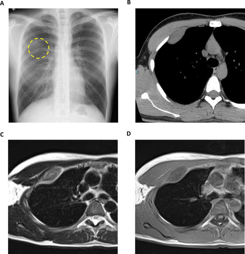 Fig. 1