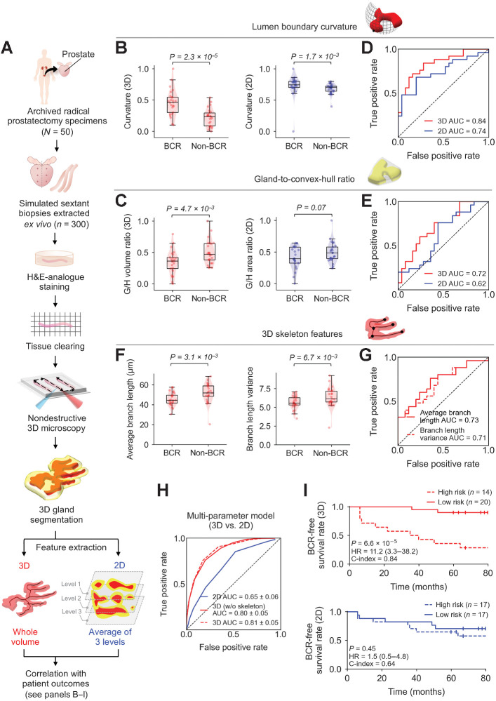 Figure 4. Clinical study comparing the performance of 3D versus 2D glandular features for risk stratification. A, Archived (FFPE) RP specimens were obtained from a well-curated cohort of 50 patients, from which, 300 simulated (ex vivo) needle biopsies were extracted (6 biopsies per case, per sextant-biopsy protocol). The biopsies were labeled with a fluorescent analogue of H&E staining, optically cleared to render the tissues transparent to light, and then comprehensively imaged in 3D with OTLS microscopy. Prostate glands were computationally segmented from the resultant 3D biopsy images using the ITAS3D pipeline. Three-dimensional glandular features were extracted from tissue volumes containing prostate cancer. Two-dimensional glandular features were extracted from three levels per volume and averaged. B and C, Violin and box plots are shown for two examples of 3D glandular features, along with analogous 2D features, for cases in which BCR was observed within 5 years of RP (“BCR”) and for cases with no BCR within 5 years of RP (“non-BCR”). For both sets of example features, “lumen boundary curvature” in B and “gland-to-convex hull ratio” (G/H) in C, the 3D version of the feature shows improved stratification between BCR and non-BCR groups. D and E, ROC curves also show improved risk stratification with the 3D features versus corresponding 2D features, with considerably higher AUC values. F, Violin and box plots are shown of representative gland-skeleton features (average branch length and branch length variance), which can only be accurately derived from the 3D pathology datasets, showing significant stratification between BCR and non-BCR groups. G, ROC curves are shown, along with AUC values, for average branch length and branch length variance. H, ROC curves are shown of various multiparameter models, including those trained with 2D glandular features, 3D glandular features excluding skeleton features, and 3D glandular features including skeleton features. I, KM curves are shown for BCR-free survival, showing that a multiparameter model based on 3D glandular features is better able to stratify patients into low-risk and high-risk groups with significantly different recurrence trajectories (P = 6.6 × 10–5, HR = 11.2, C-index = 0.84).