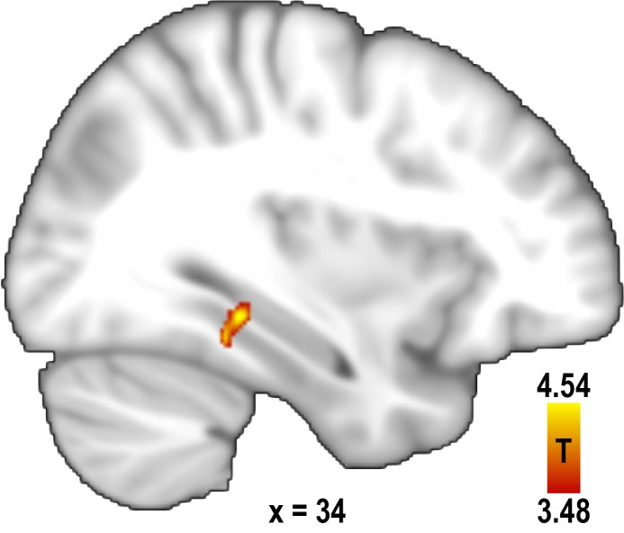 Figure 2—figure supplement 1.