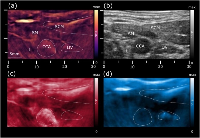 Fig. 2