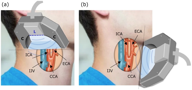 Fig. 1