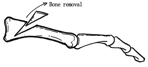 Figure 22.