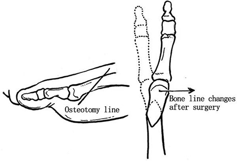 Figure 25.