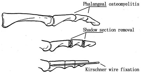 Figure 11.