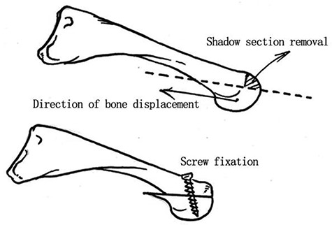 Figure 13.