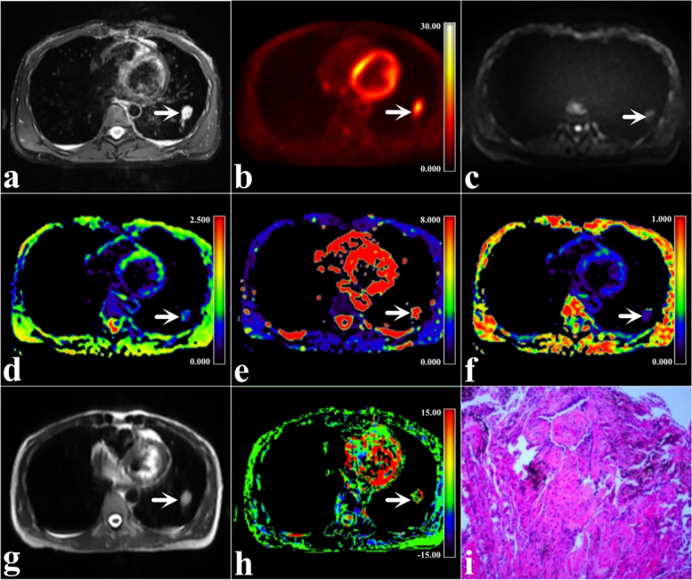 Fig. 2