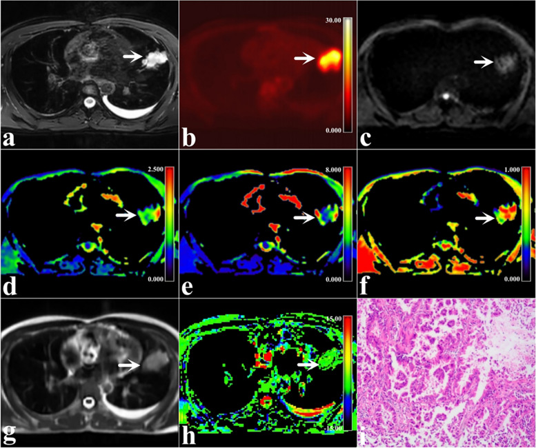 Fig. 3