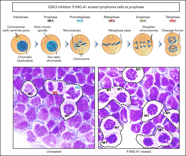 graphic file with name blood874560absf1.jpg