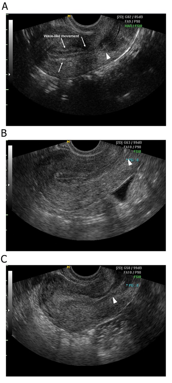 Fig 1