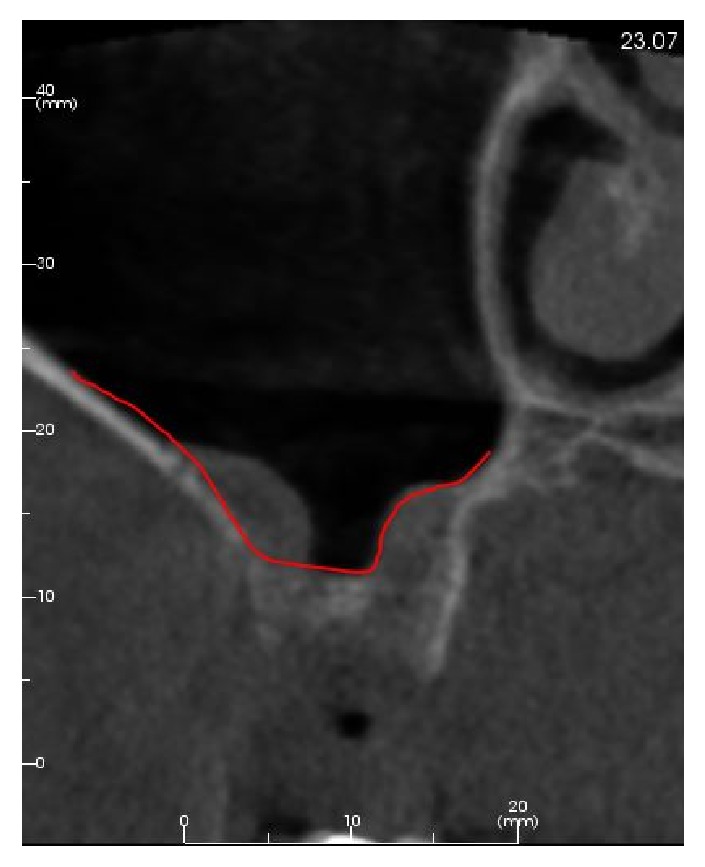 Figure 4