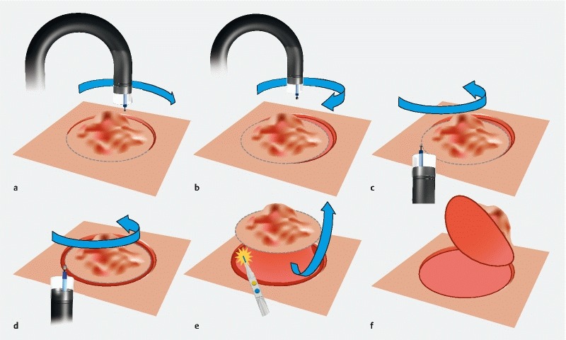 Fig. 1