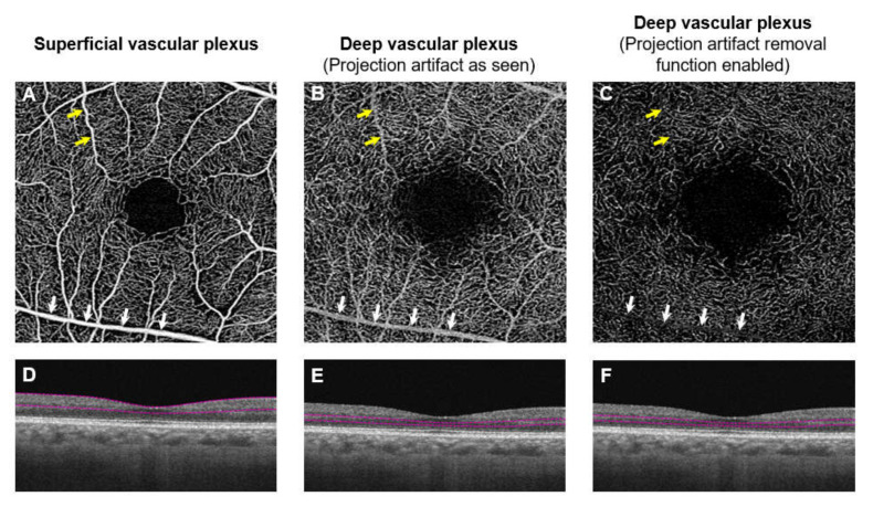 Figure 10