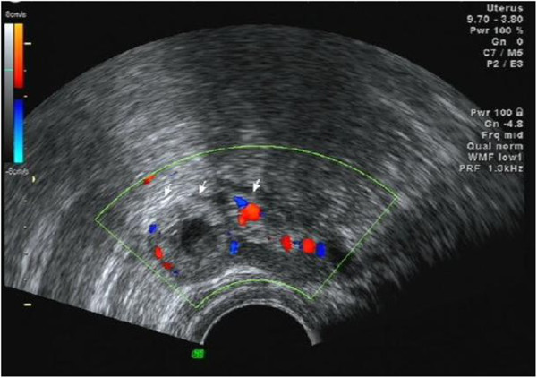 Figure 4