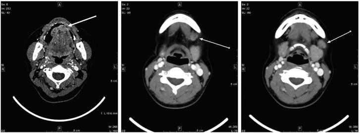 Fig. 1