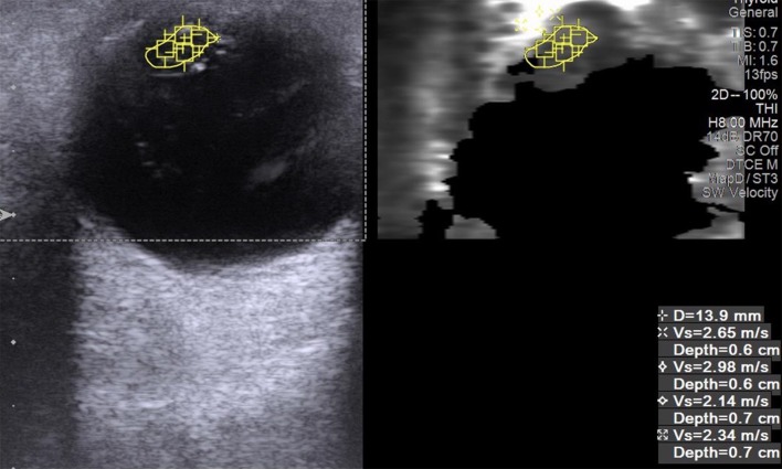 Fig. 2