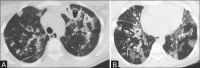 Figure 18 (A and B)