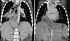 Figure 19 (A and B)