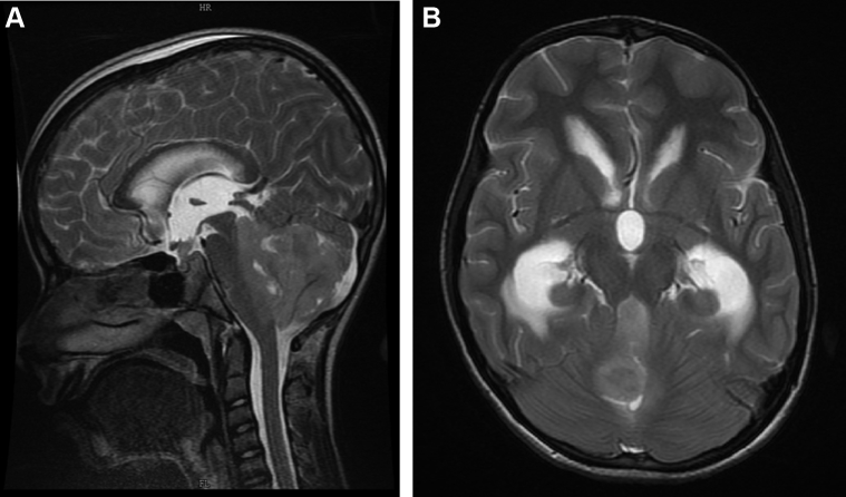 Figure 3