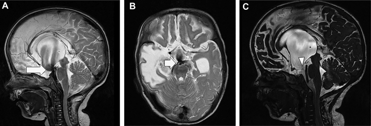 Figure 2