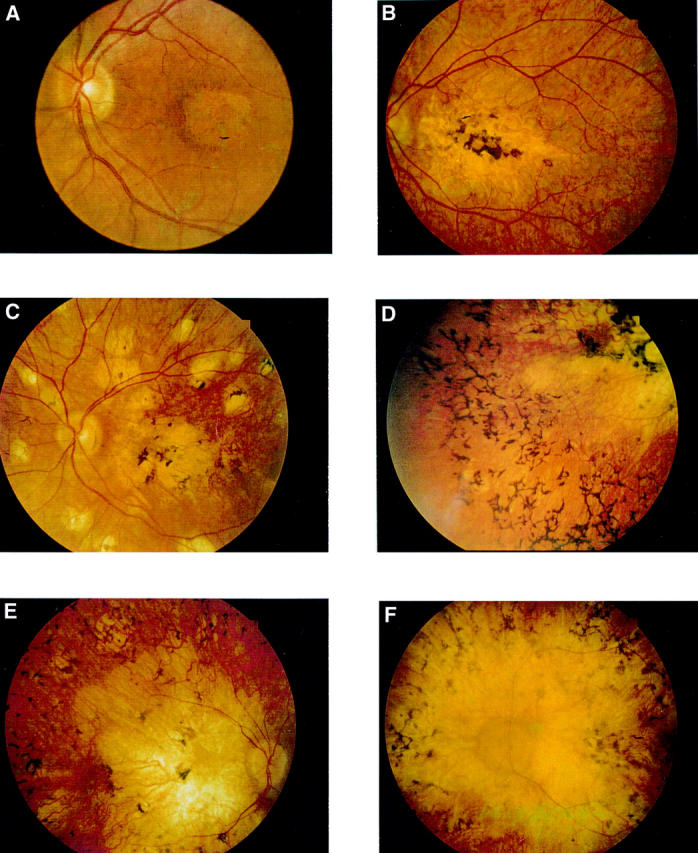 Figure 2  