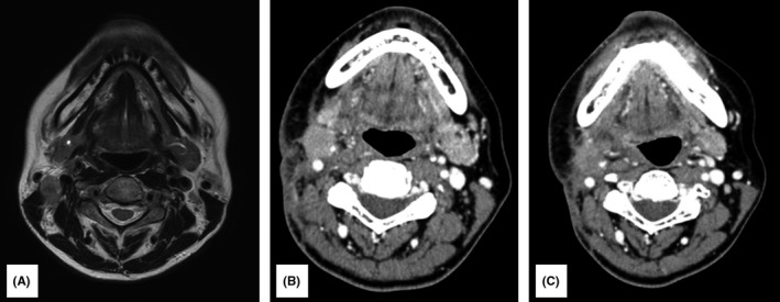 FIGURE 2