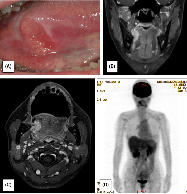 FIGURE 1