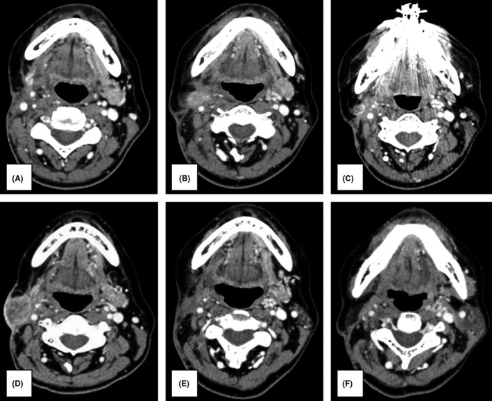 FIGURE 3