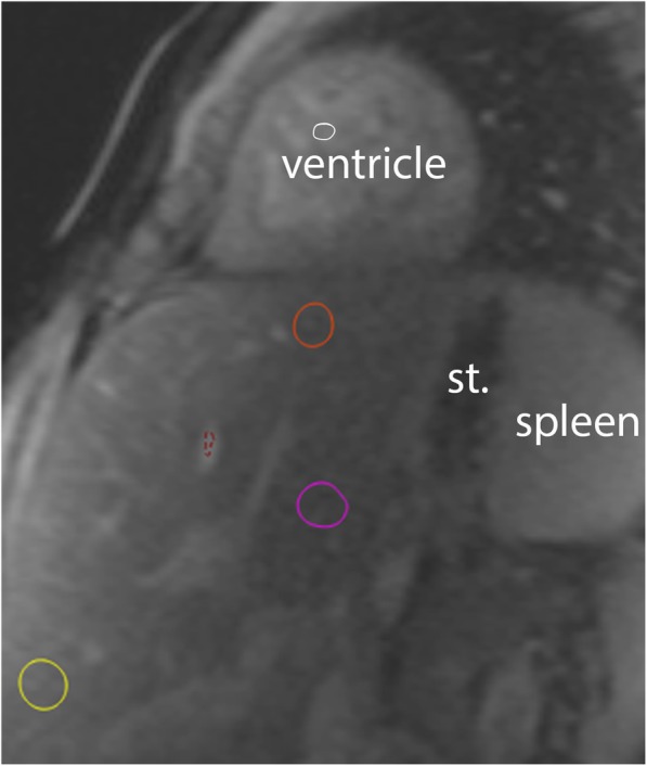 Fig. 1