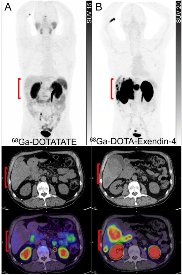 Fig. 10