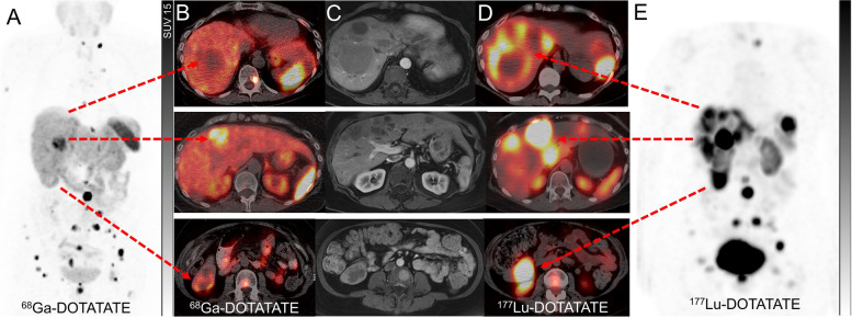 Fig. 11