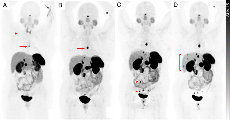 Fig. 12