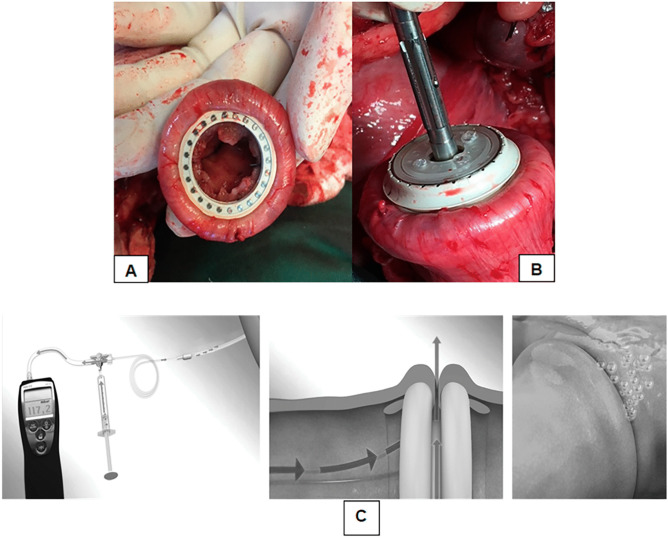 Fig. 2