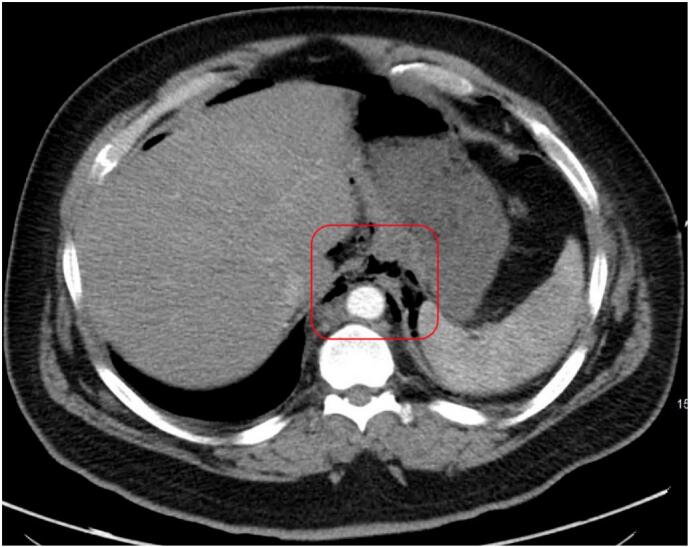 Fig. 2