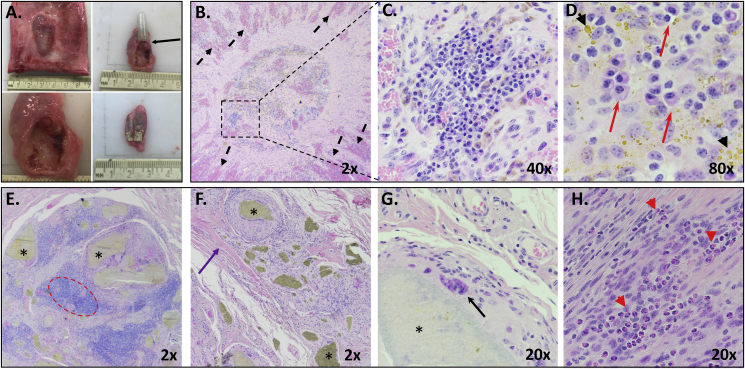 Fig. 4