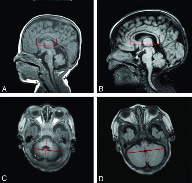 Fig 1.