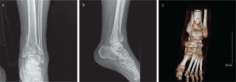 Figure 1. a–c