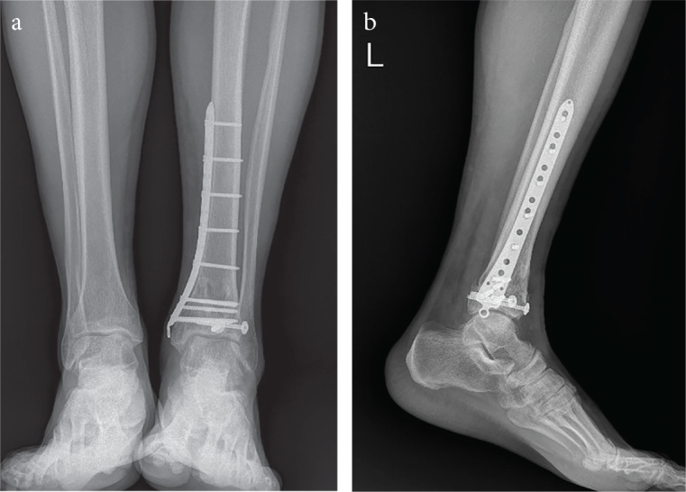 Figure 2. a, b