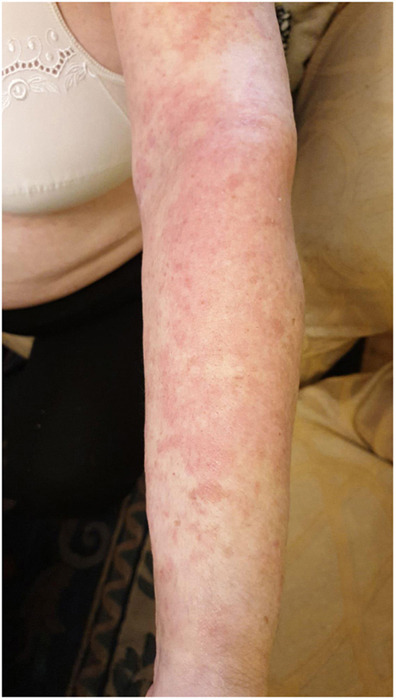 Fig. 2 Upper-limb lesions