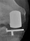 Fig. 4