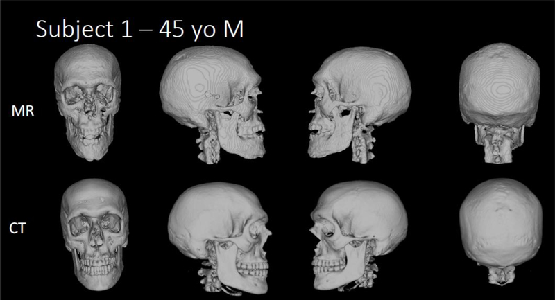 Figure 3a-e b