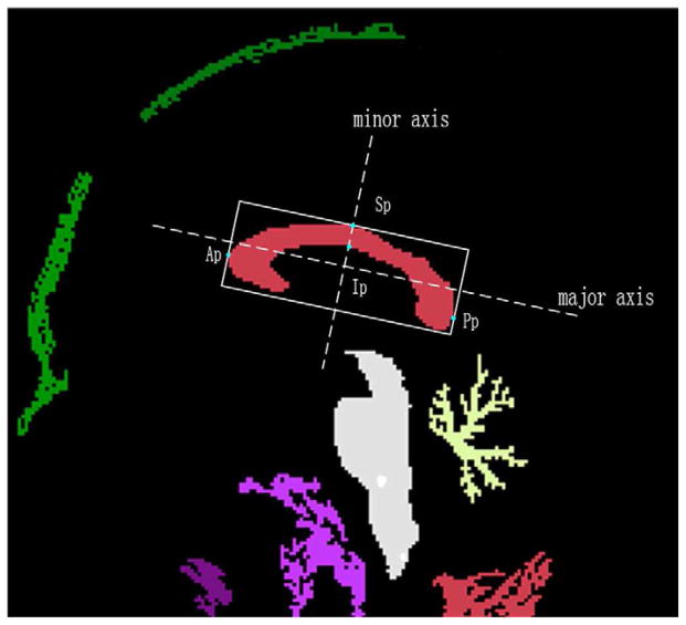 Fig. 3