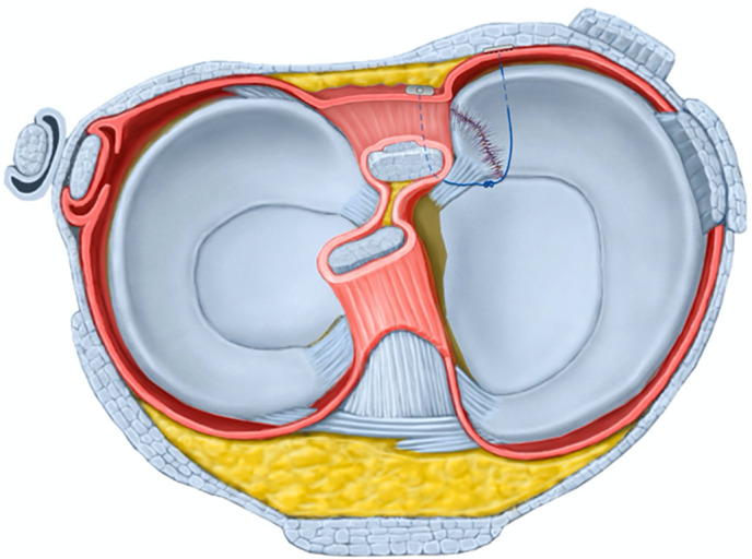 Fig. 3