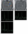 Figure 1a-e