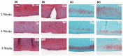 Here are the 16-word descriptions generated using the context data provided, "In two, four, and eight-week intervals, observe tibia specimens stained with hematoxylin, eosin, and Safranin O under magnification, noting the difference between control and TXA-treated limbs.