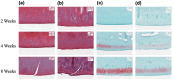 Describe a collection of 2-, 4-, and 8-week femur specimen images, including control and tranexamic acid-treated femurs, stained with hematoxylin, eosin, and Safranin O at magnifications of 20x and 10x
