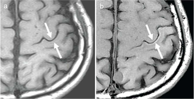 Fig 2.