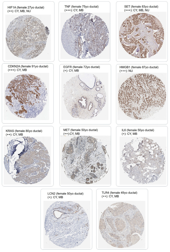 Adverse Crosstalk between Extracellular Matrix Remodeling and ...