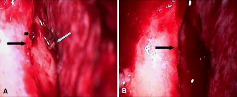 Fig. 9