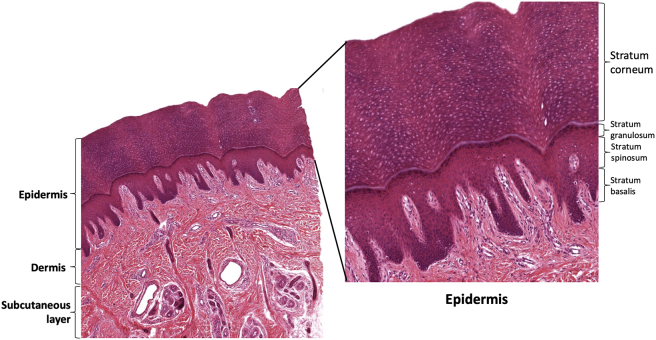 Figure 1